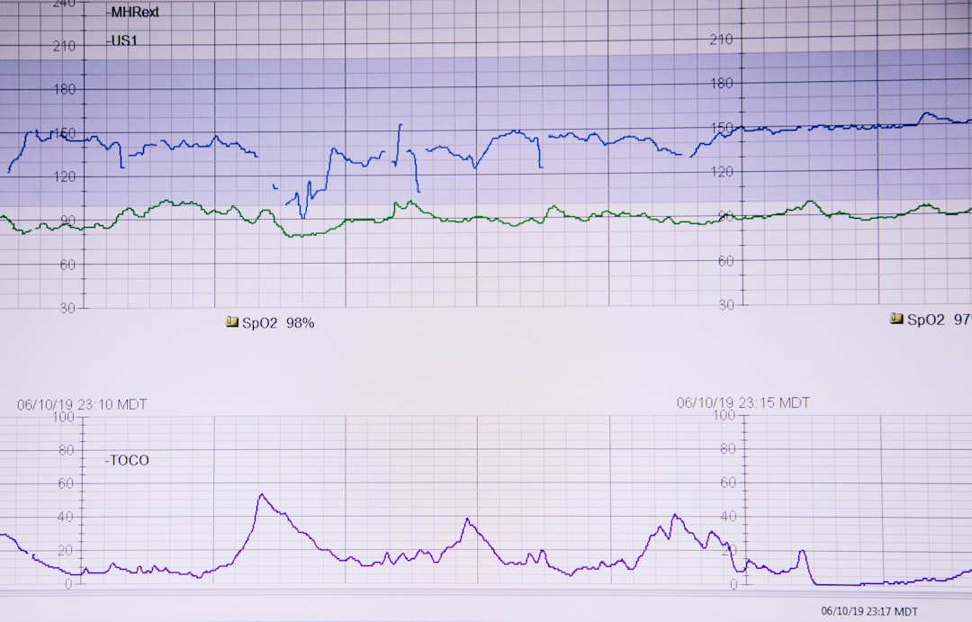 Patient monitor screen showing two SpO2 lines in blue and green with values around 98% and 97%, plus a TOCO tracing below.
